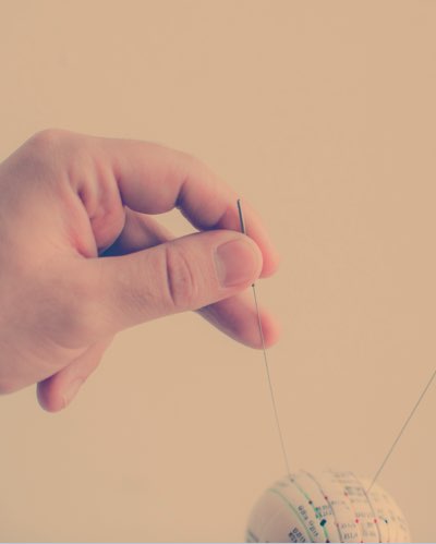 acupuncture-41